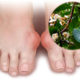 CBD For Gout